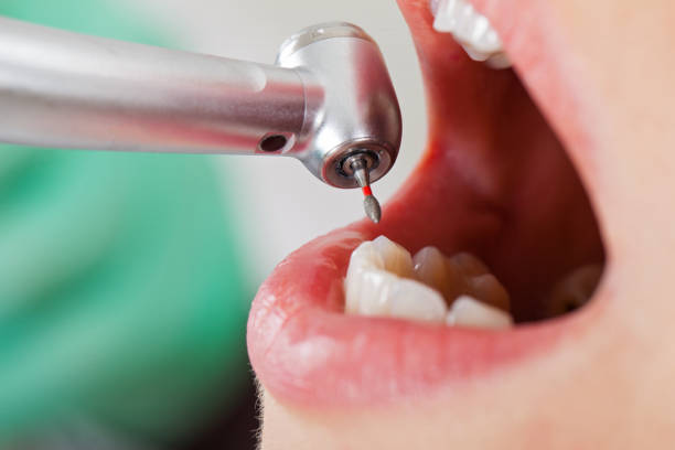 Best Emergency Broken Tooth Repair in Tellico Plains, TN